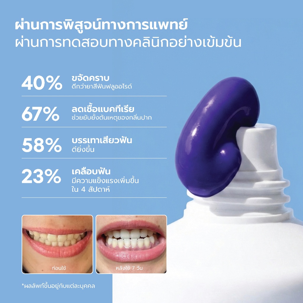 L!NEE Aura White ยาสีฟันลดคราบเหลือง รูปที่ 3