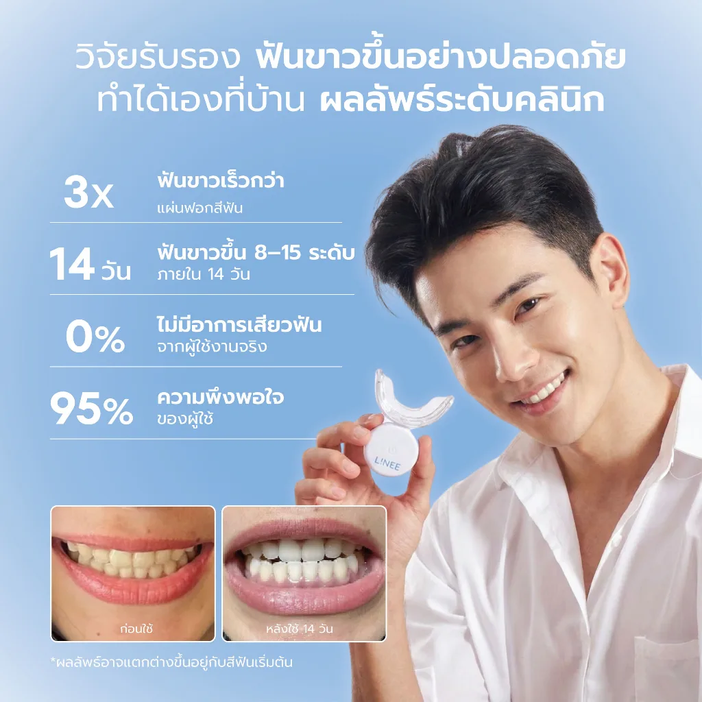 L!NEE Teeth Whitening Kit Premium รูปที่ 7